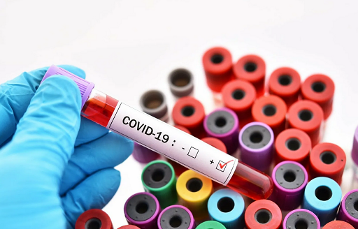 Как оформить сертификат по результату теста на антитела к Covid-19?