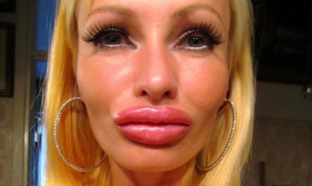 Кто сказал что накаченные губы красиво и кому-то нравятся?
